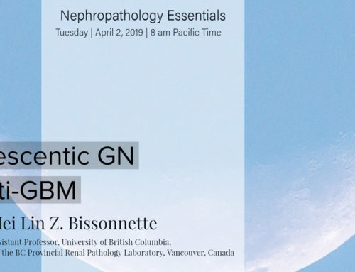 Crescentic Glomerulonephritis and Anti-GBM Disease